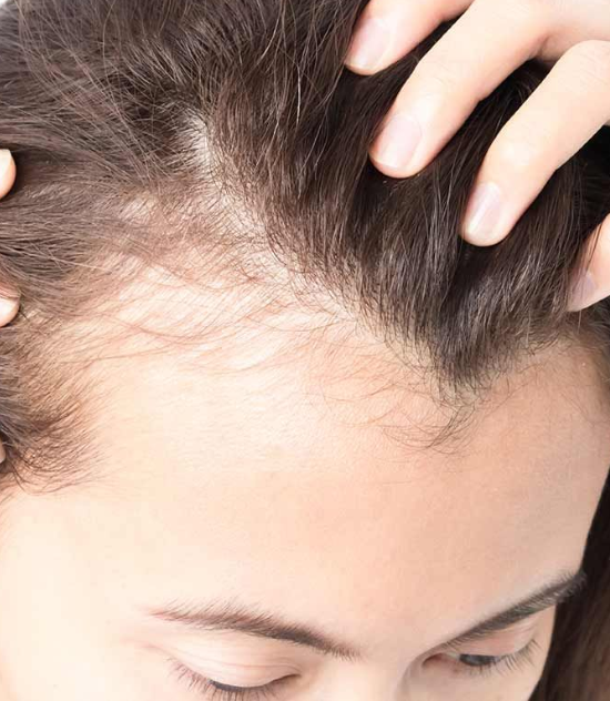 Hair Treatment