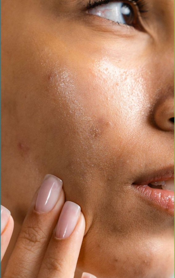 removal of warts, skin tag,moles